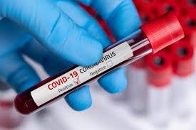 COVID-19: NCDC records 41 new infections, no death